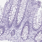 Immunohistochemical staining of human colon shows no positivity in glandular cells as expected.