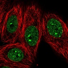 Anti-EHMT1 Antibody