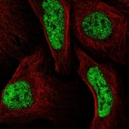 Anti-LCORL Antibody