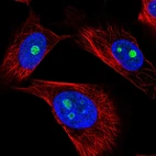 Immunofluorescent staining of human cell line U-251 MG shows localization to nucleoli.