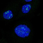 Anti-NRIP1 Antibody