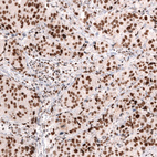 Anti-MSH2 Antibody