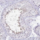 Anti-IRGC Antibody