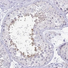 Immunohistochemical staining of human testis shows high expression.