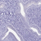 Immunohistochemical staining of human endometrium shows low expression as expected.