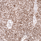 Anti-MSH2 Antibody