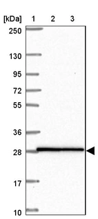 Lane 1: Marker [kDa] 250, 130, 95, 72, 55, 36, 28, 17, 10_br/_Lane 2: Human cell line RT-4_br/_Lane 3: Human cell line U-251MG sp