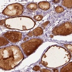 Immunohistochemical staining of human thyroid gland shows high expression.