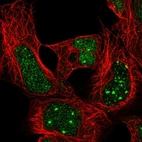 Immunofluorescent staining of human cell line HEK 293 shows localization to nuclear bodies.