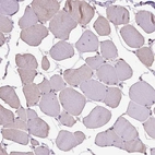 Immunohistochemical staining of human skeletal muscle shows low expression as expected.