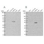 Anti-EED Antibody