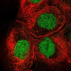 Immunofluorescent staining of human cell line A-431 shows localization to nucleoplasm.