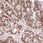 Anti-MSH2 Antibody