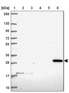 Lane 1: Marker [kDa] 250, 130, 95, 72, 55, 36, 28, 17, 10_br/_Lane 2: Human cell line RT-4_br/_Lane 3: Human cell line U-251MG sp_br/_Lane 4: Human plasma (IgG/HSA depleted)_br/_Lane 5: Human liver tissue_br/_Lane 6: Human tonsil tissue