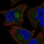 Anti-COL20A1 Antibody