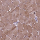 Immunohistochemical staining of human skeletal muscle shows high expression.