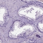 Immunohistochemical staining of human prostate shows low expression as expected.