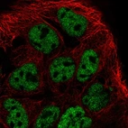 Immunofluorescent staining of human cell line CACO-2 shows localization to nucleoplasm.