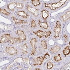 Anti-SAA4 Antibody