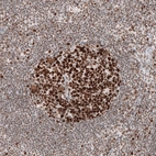 Immunohistochemical staining of human lymph node shows strong nuclear positivity in germinal center cells.