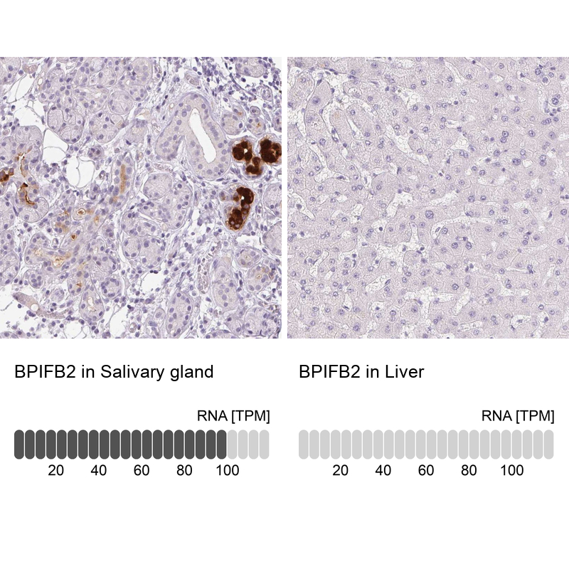 Anti-BPIFB2 Antibody