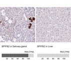 Anti-BPIFB2 Antibody