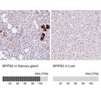 Anti-BPIFB2 Antibody
