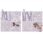 Immunohistochemical staining of human colon, kidney, liver and salivary gland using Anti-BPIFB2 antibody HPA060121 (A) shows similar protein distribution across tissues to independent antibody HPA049491 (B).