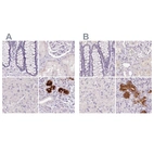 Immunohistochemical staining of human colon, kidney, liver and salivary gland using Anti-BPIFB2 antibody HPA060121 (A) shows similar protein distribution across tissues to independent antibody HPA049491 (B).