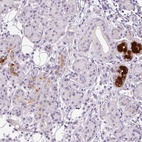 Anti-BPIFB2 Antibody