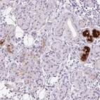 Immunohistochemical staining of human salivary gland shows high expression.