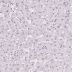 Anti-BPIFB2 Antibody