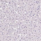 Immunohistochemical staining of human liver shows low expression as expected.