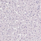 Immunohistochemical staining of human liver shows low expression as expected.