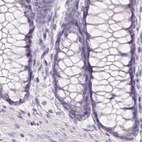 Anti-BPIFB2 Antibody