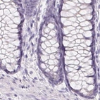 Immunohistochemical staining of human colon using Anti-BPIFB2 antibody HPA060121.