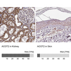 Anti-ACOT2 Antibody