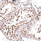 Immunohistochemical staining of human testis shows strong nuclear positivity in cells in seminiferous ducts.