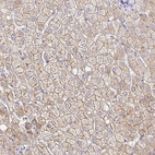 Anti-MYO1B Antibody