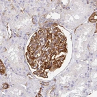 Immunohistochemical staining of human kidney shows strong membranous positivity in cells in glomeruli.