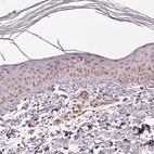 Anti-ACOT2 Antibody