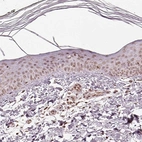 Immunohistochemical staining of human skin shows low expression as expected.