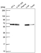 Western blot analysis in human cell line RT-4, human cell line U-251 MG, human plasma, human liver tissue and human tonsil tissue.