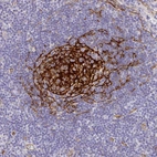 Immunohistochemical staining of human lymph node shows strong membranous positivity in germinal center cells.