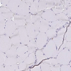 Immunohistochemical staining of human skeletal muscle shows no positivity in myocytes as expected.