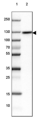 Lane 1: Marker [kDa] 250, 130, 100, 70, 55, 35, 25, 15, 10_br/_Lane 2: Human cell line PC-3