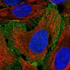 Immunofluorescent staining of human cell line U-2 OS shows localization to plasma membrane.