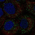 Anti-PPP1R11 Antibody