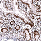 Immunohistochemical staining of human small intestine shows strong nuclear positivity in glandular cells.