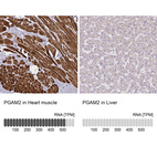 Anti-PGAM2 Antibody